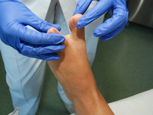 El SESCAM ha ofrecido más de 5.300 tratamientos podológicos gratuitos a pacientes diabéticos