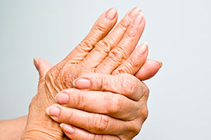 La osteoporosis afecta a unas 16.000 personas en Castilla-La Mancha
