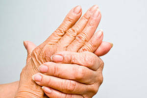 La osteoporosis afecta a unas 16.000 personas en Castilla-La Mancha