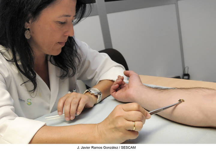 La inmunoterapia con extracto purificado de venenos, clave para el tratamiento de la alergia a veneno de abejas y avispas