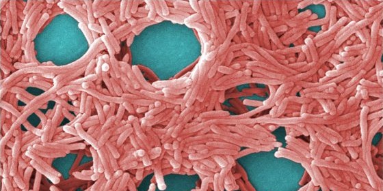 Comunicado de la Plataforma de Afectados por Legionela de Manzanares: Indignación