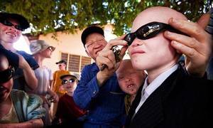 Profesionales del Hospital de Guadalajara recogen de gafas de sol para la poblaci&#243;n albina de Tanzania