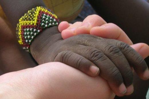 Una cirujana del Hospital de Guadalajara ha participado en una campaña quirúrgica en Kenia a través del proyecto Cirugía en Turkana