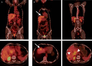 Page anuncia que Guadalajara tendrá en junio un PET-TAC, una de las pruebas más efectiva para la detección del cáncer