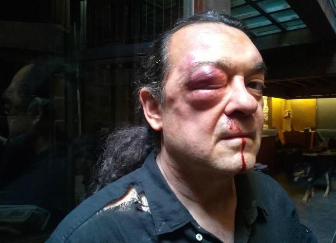 El abogado del podemita Fernando Barredo explica cómo fue la brutal paliza