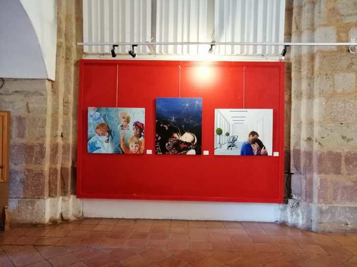 Hiperrealismo, contra el Síndrome de Angelman