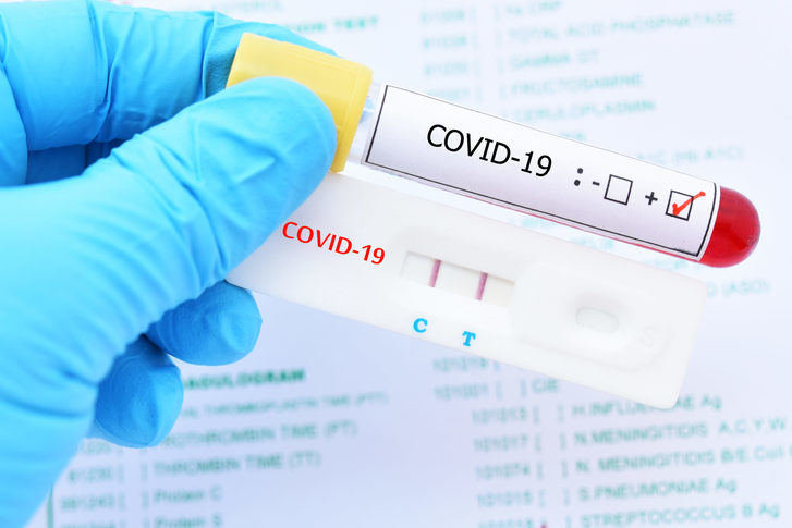 De 4.614 nuevos casos por infección de coronavirus detectados este martes en CLM, 432 son de Guadalajara