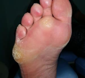 El Colegio de Podólogos de Castilla-La Mancha critica la formación online impartida por la Junta socialista de Page